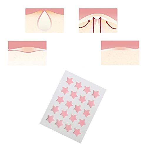 AGRCARE Hydrocolloid Acne Pimple Patch - Clear Absorbing Stickers 40 Count