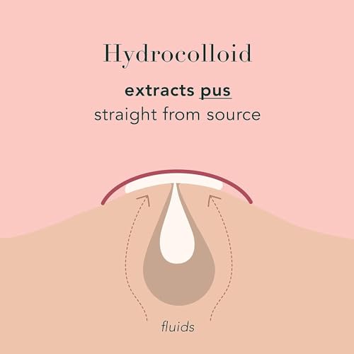 a.l.m. Magical Hydrocolloid Pimple Patches - Invisible Acne Spot Treatment