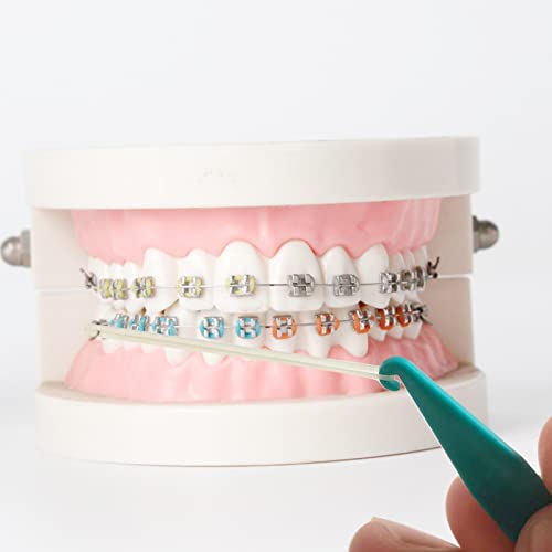 Dental Elastic Rubber Band Placers for Braces - 20 Pack