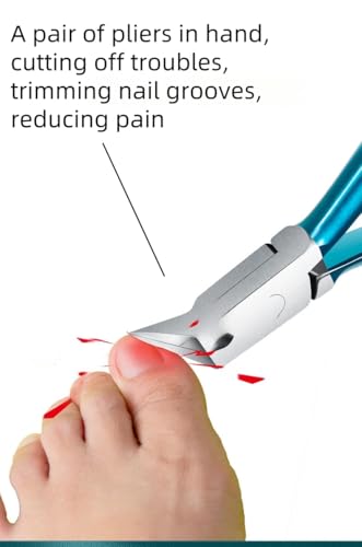 Ingrown Toenail Clippers - 120° Angled Stainless Steel Tool for Thick Nails