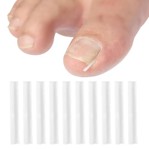 Ingrown Toenail Correction Strips Brace Kit - 10 Pcs Pedicure Tool