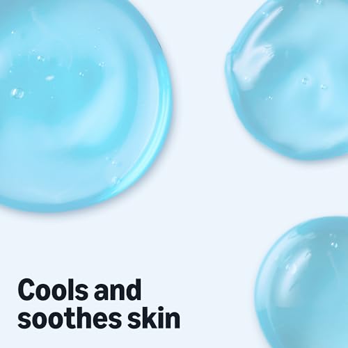 Amazon Essentials After Sun Gel with Aloe Vera, Lidocaine and Menthol, 16 oz