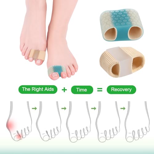 SEBS Toe Spacers & Bunion Correctors for Hallux Valgus Relief 4-Pack