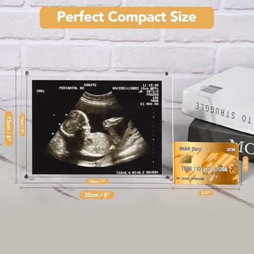 6x8 Magnetic Acrylic Ultrasound Picture Frame - Rectangle Sonogram Keepsake
