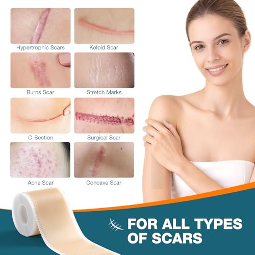 Vakimou Silicone Scar Tape Roll for Surgical, C-Section & Keloid Scars