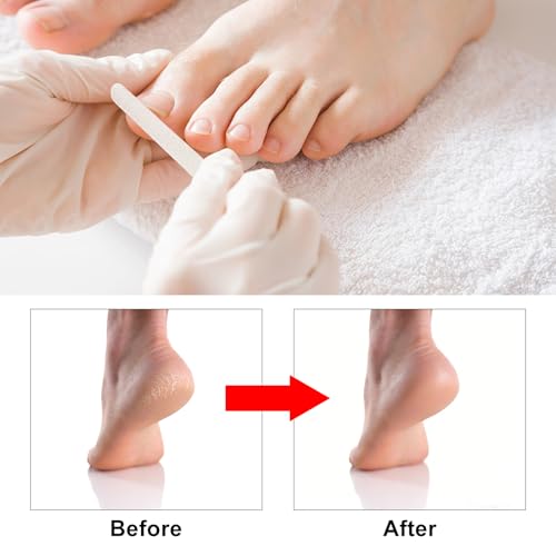 MYLMAC 7-Piece Professional Pedicure Tool Kit Stainless Steel Foot Care Set