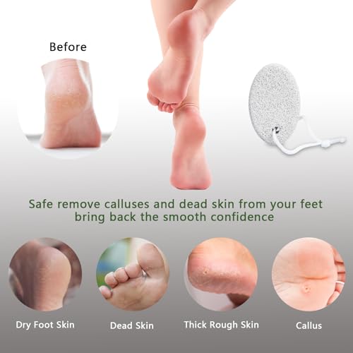 Borogo Natural Foot Pumice Stone 2-Pack - Lava Pedicure Callus Remover