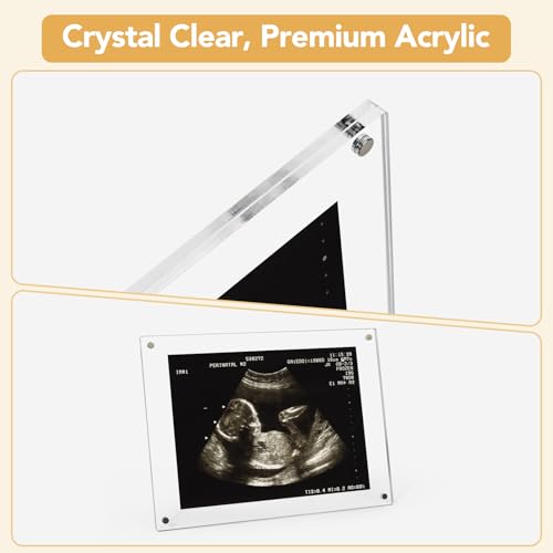 6x8 Magnetic Acrylic Ultrasound Picture Frame - Rectangle Sonogram Keepsake