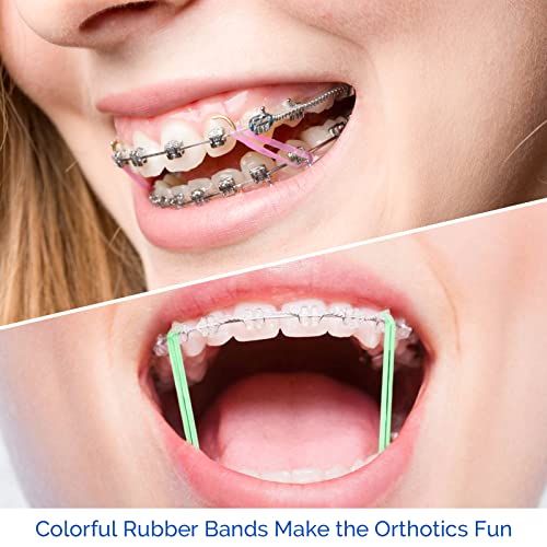 JMU Orthodontic Elastics 1/4 Inch Heavy 500 Pack Dental Rubber Bands