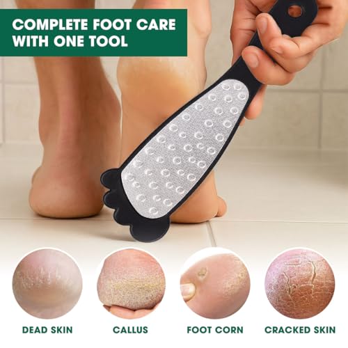 Hotosu Stainless Steel Double-Sided Foot File and Callus Remover for Wet and Dry Skin