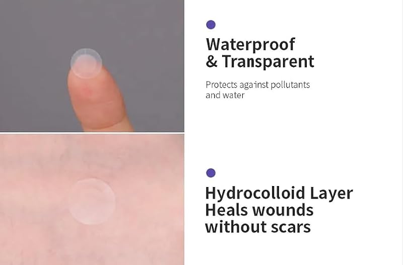 a.l.m. Magical Hydrocolloid Pimple Patches - Invisible Acne Spot Treatment