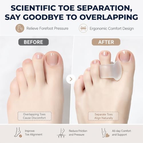 FoglessVue Gel Toe Separators 12-Pack, Soft Single-Loop Bunion Cushions