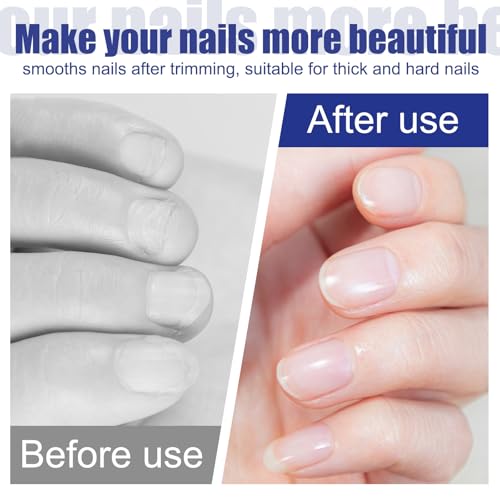 Zelphvt 12 Pcs Metal Nail Files - 3.6 Inch Stainless Steel Fingernail Files with Cleaner Tip