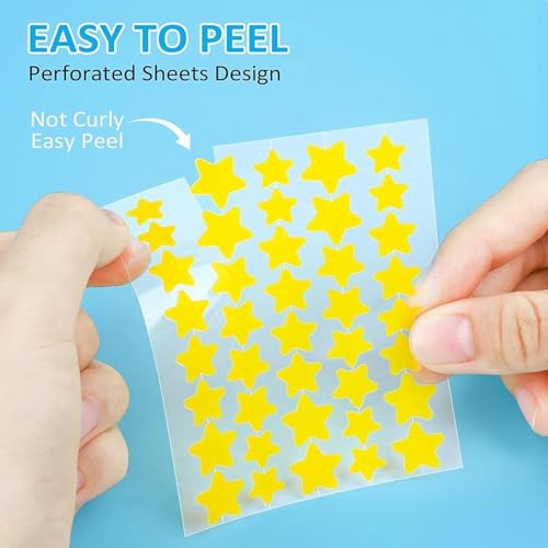 Star Pimple Patches - 400 Hydrocolloid Acne Spot Treatment Stickers