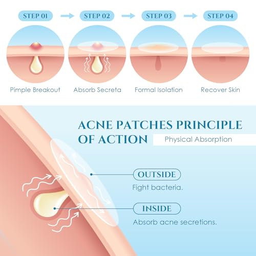PITHER Hydrocolloid Pimple Patches - 288 Count Acne Zit Stickers