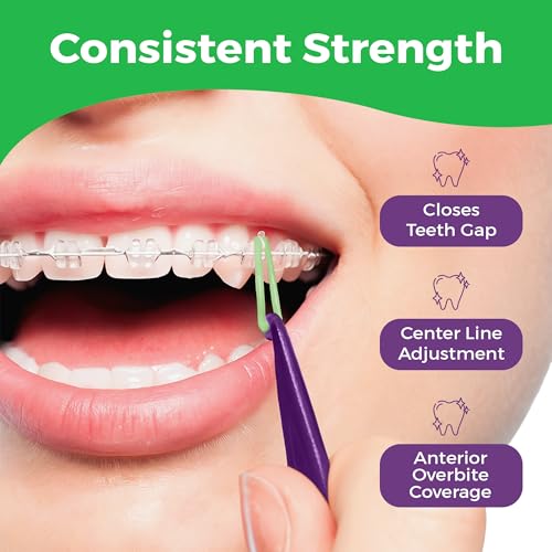 Prairie Horse Supply Orthodontic Rubber Bands 1/4 Inch Medium Neon 100 Pack with Placer