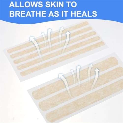 48 Strips Skin Closure 2 Sizes Adhesive Wound Closures Strips Breathable Strip for Closing Small Cuts Wounds