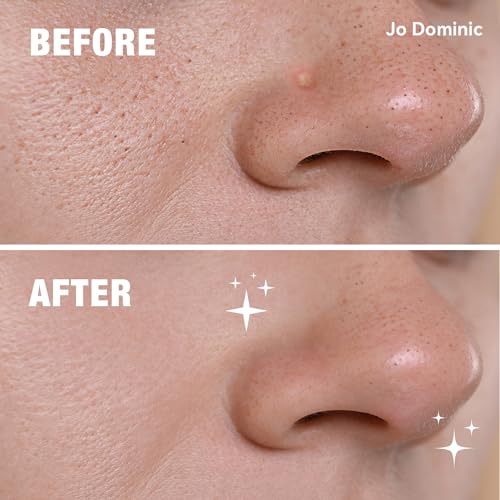 Jo Dominic Hydrocolloid Nose & Chin Pimple Patches – 15 Count
