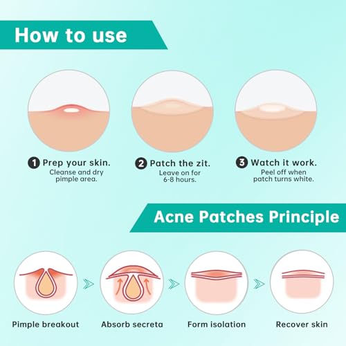 Aquuaera Hydrocolloid Pimple Patches 210 Count - Acne Spot Care