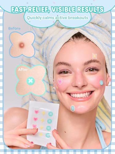 SHEGLAM Daydream Dots Salicylic Acid Blemish Patches, 24 Count