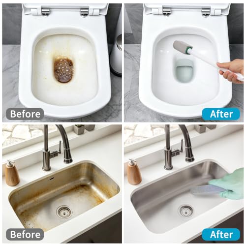 Pumice Stone Toilet Bowl Cleaner Set with Handle & 8 Refills