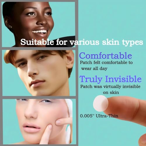 Guiyal Hydrocolloid Acne Patches with Essential Oils - 112 Pcs