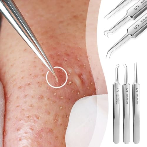 Jizlan 3-Piece Professional Blackhead Removal Tweezer Set Stainless Steel