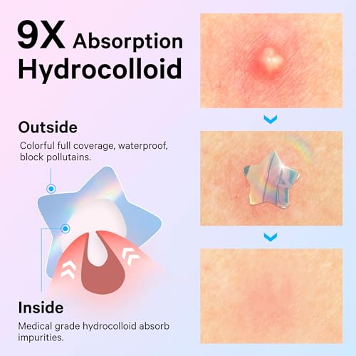 Sosky Holographic Pimple Patches 48ct - Cute Hydrocolloid Acne Stickers with Salicylic Acid