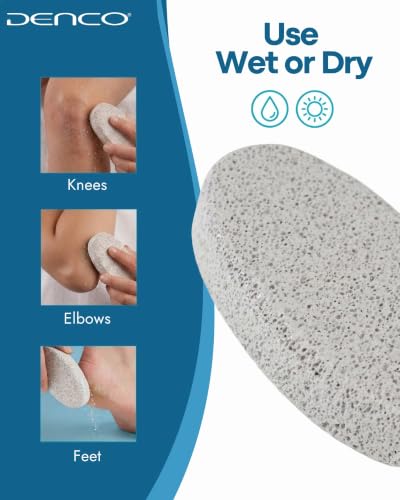 Denco Pumice Stone Callus Remover & Natural Foot Scrubber for Dead Skin