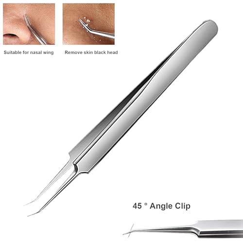 Blackhead Tweezers and Pimple Popper Tool Kit 3-Piece Stainless Steel