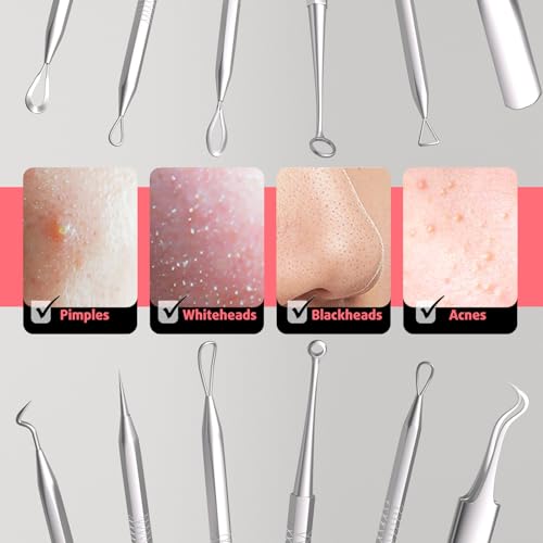 Cbiumpro 6-Piece Blackhead Remover Tool Kit & Pimple Popper Set