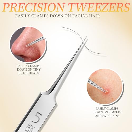 Teenitor 4-Piece Blackhead Remover Tweezers & Pimple Popper Kit
