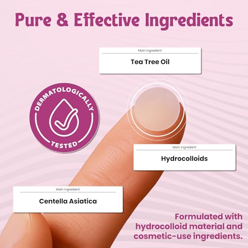 Andlane 344 Pcs Large Hydrocolloid Pimple Patches – 7 Sizes & Shapes for Face and Body