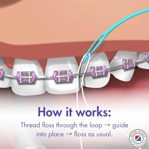 Acclean Dental Floss Threaders for Braces, Bridges & Implants 50 Ct