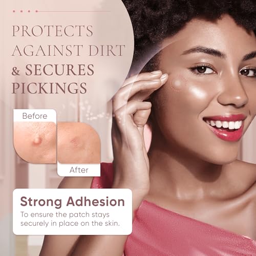 Zing Prime Clear Hydrocolloid Pimple Patches 45 Count - Vegan Acne Dots