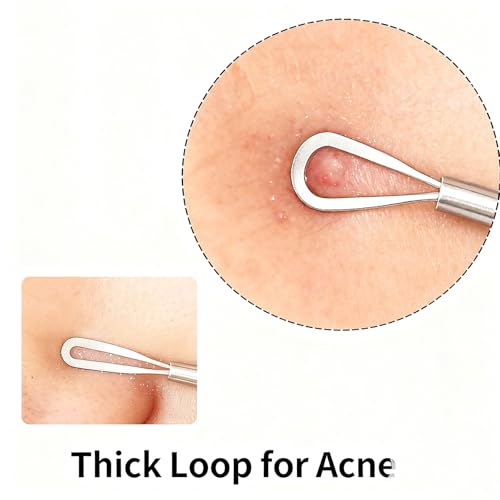 Blackhead Remover Tool 4 Pcs Stainless Steel Pimple Acne Extractor