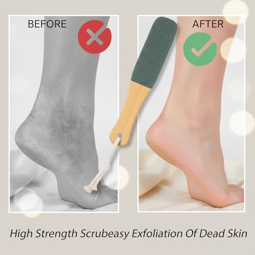 Zelphvt 3-Pack Wooden Handle Foot Scrubber & Callus Remover File