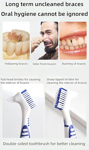 RyanDesign Denture Cleaning Brush 2-Pack with Dual-Angle Heads