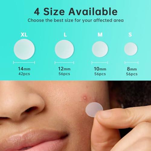 Aquuaera Hydrocolloid Pimple Patches 210 Count - Acne Spot Care