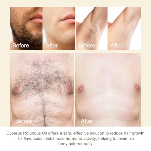 Nifeishi Cyperus Rotundus Hair Removal Oil 60ml