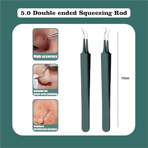 Professional Blackhead Extraction Tweezers & Acne Removal Tool Set