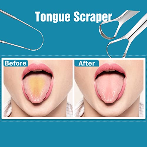 3 PCS Stainless Steel Tongue Scraper - Metal Tongue Cleaner for Adults