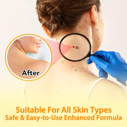 Arbcrn Bee Venom Face & Body Cream – Hydrating & Soothing Moisturizer 3.52 oz