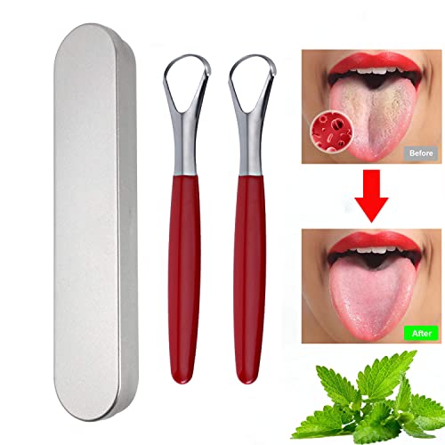 MEOOAWQI Stainless Steel Tongue Scraper 2-Pack - Metal Tongue Cleaner for Bad Breath