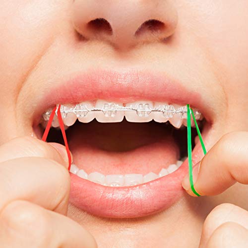 JMU Orthodontic Elastics 3/16 Medium Force 100 Pack Dental Rubber Bands