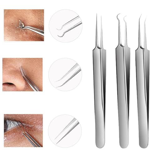 Blackhead Tweezers and Pimple Popper Tool Kit 3-Piece Stainless Steel