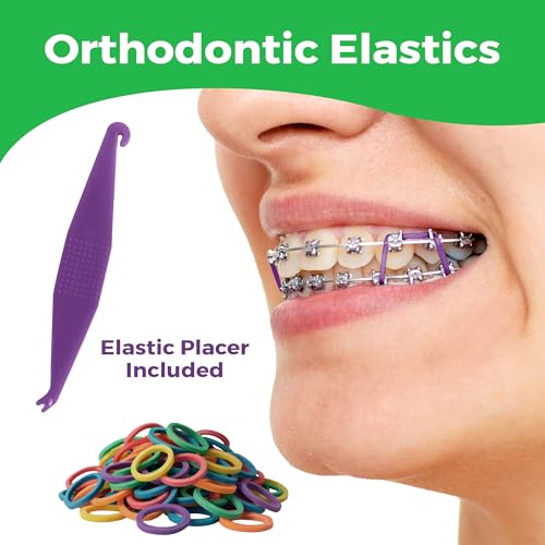 Prairie Horse Supply Orthodontic Rubber Bands 1/4 Inch Medium Neon 100 Pack with Placer
