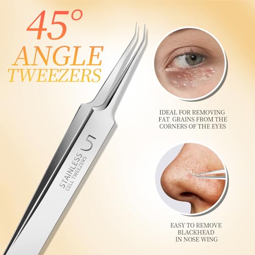 Teenitor 4-Piece Blackhead Remover Tweezers & Pimple Popper Kit