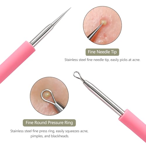 Dual-Ended Blackhead & Whitehead Extractor Tool Set