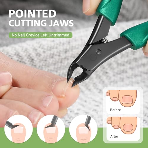 BALUCA Straight Edge Toenail Clippers for Thick and Ingrown Nails